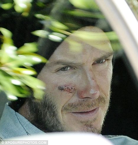 Дэвид Бэкхем