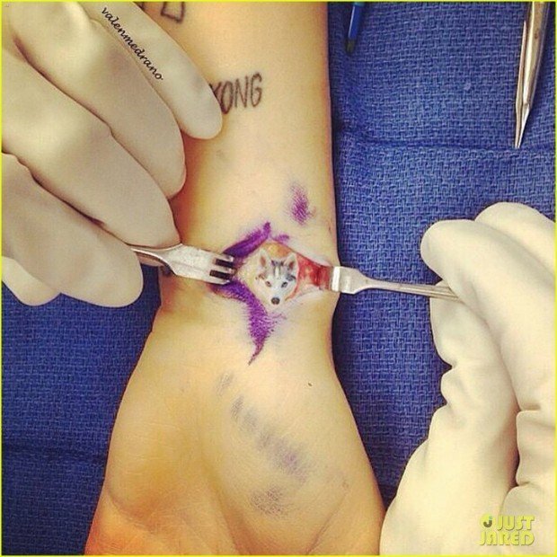 miley-cyrus-hospitalized-for-wrist-injury-02