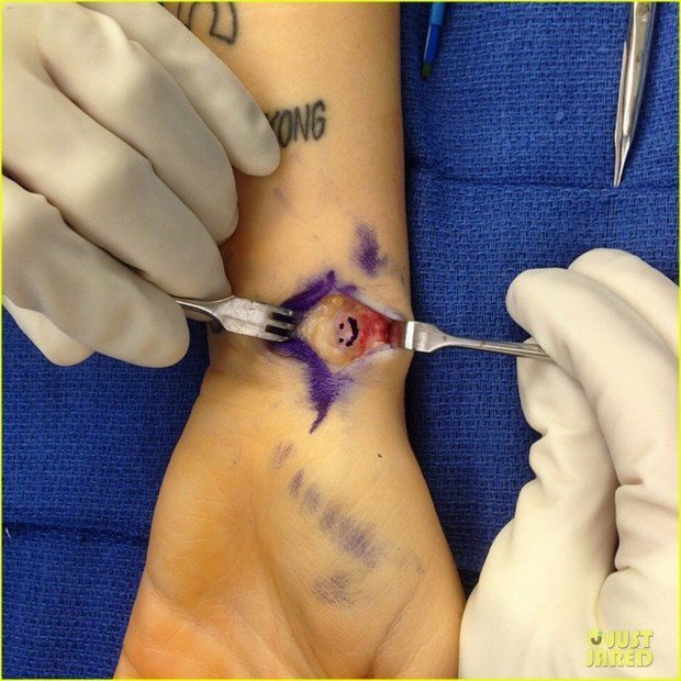 miley-cyrus-hospitalized-for-wrist-injury-05
