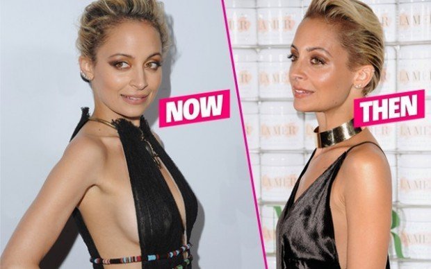Nicole-Richie-Boob-Job