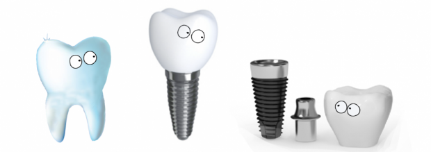 Виды имплантов