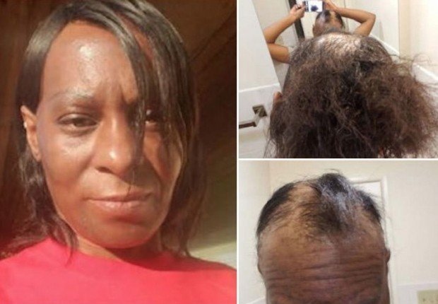 1026-l-oreal-hair-before-after-photos-launch-3