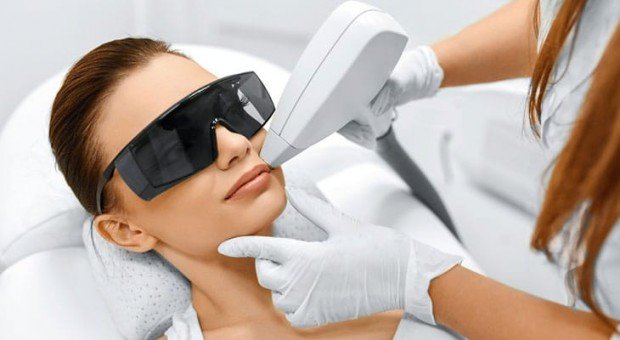 Лазерная эпиляция диодным лазером