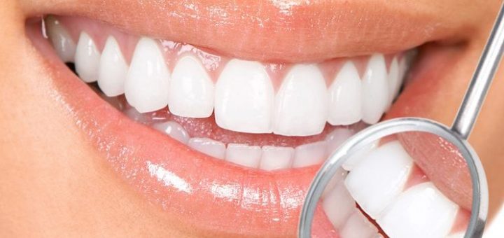 Самые безопасные методы отбеливания зубов