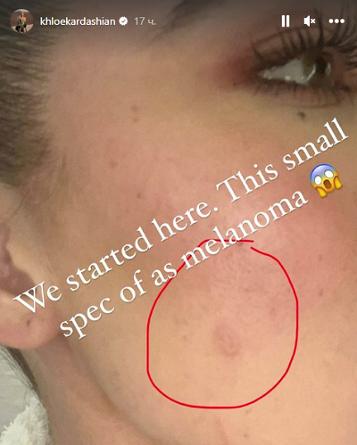 Хлои Кардашьян