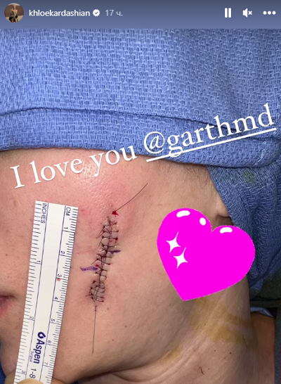 Хлои Кардашьян