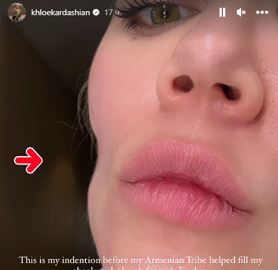 Хлои Кардашьян