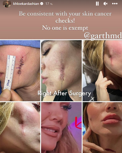 Хлои Кардашьян