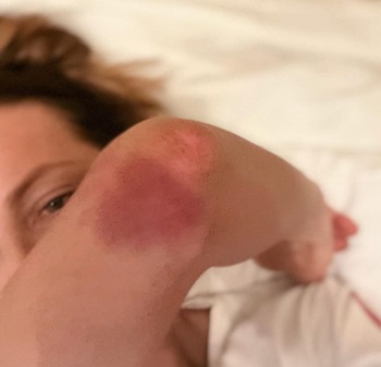 Кейт Бекинсейл