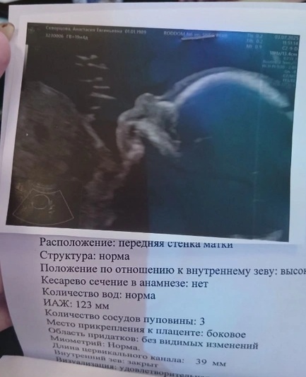 Анастасия Скворцова, беременность, коуч, ребенок, УЗИ, скриннинг